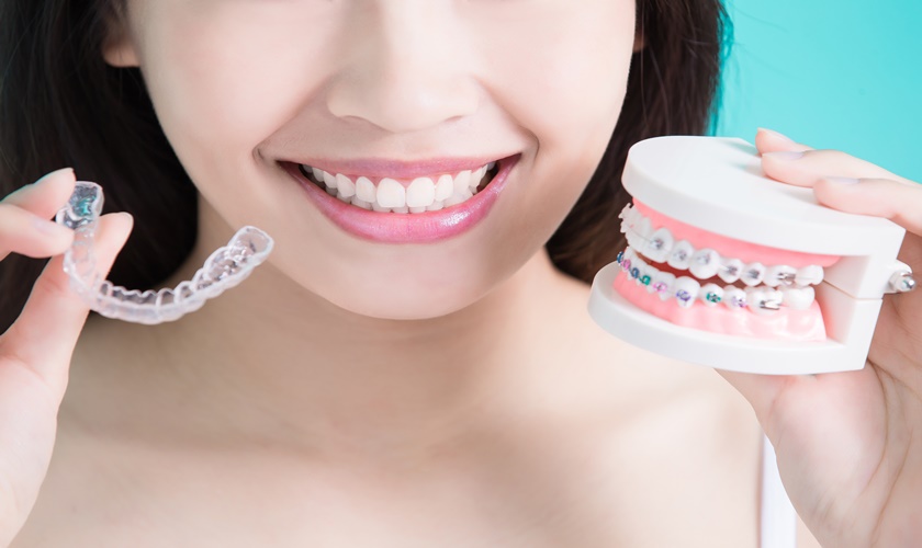 Warranty policy and condition for brace - orthodontic