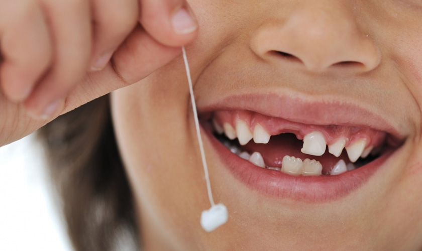 The early extraction of the primary teeth affecting the development of the jaw bone
