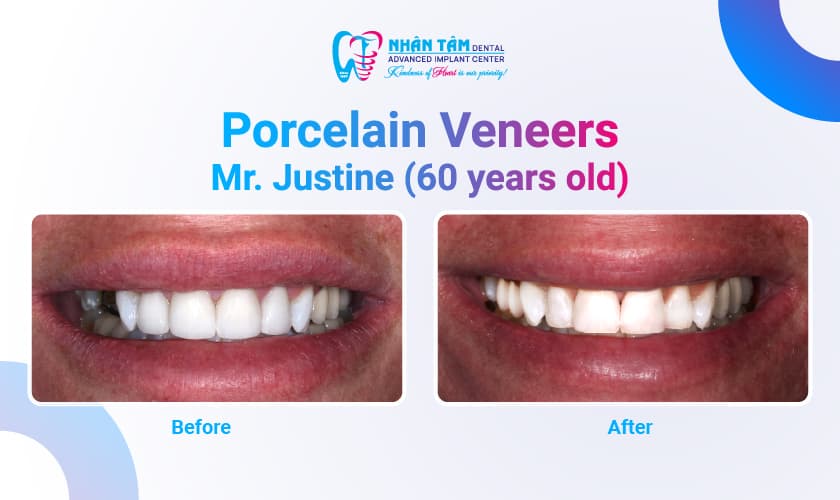 Hình: Dental Tourism Experience: Mrs. Carol & Mrs. Justine
