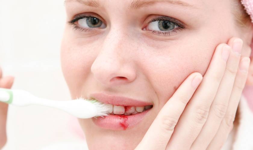 The Signs of Gum Disease