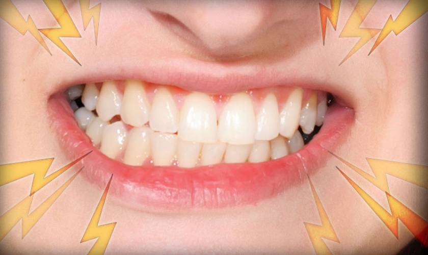 Causes of Gum Disease