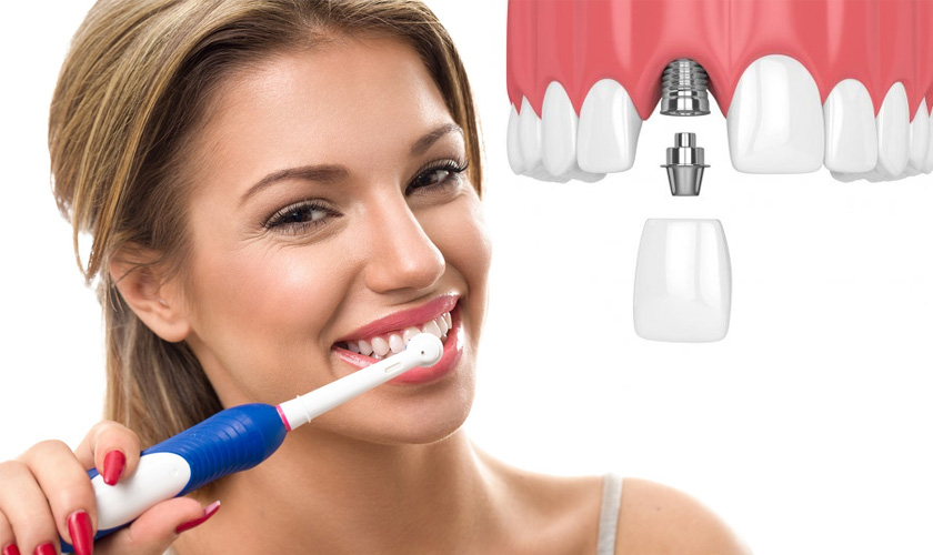 To maintain the durability of Implant teeth, patients need to take care of their teeth properly