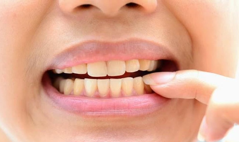 Does not affect teeth and jaws