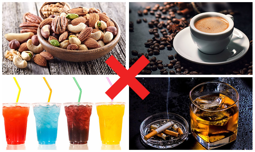 Foods to avoid after dental implants