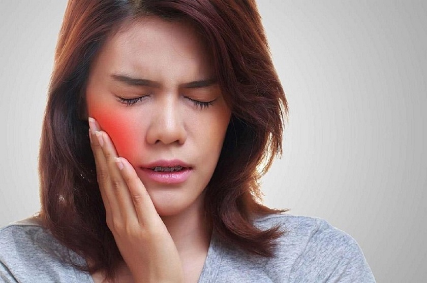 Nguyên nhân gây sưng má sau khi nhổ Tooth khôn