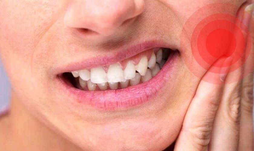 Tooth khôn mọc lệch ra má Tooth khôn mọc lệch ra má