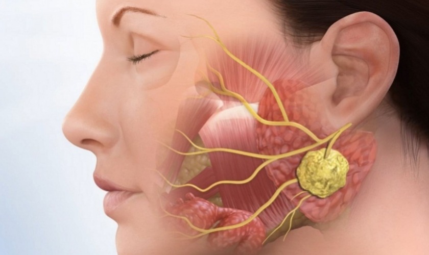 Tooth khôn mọc gây viêm khớp thái dương hàm Tooth khôn mọc gây viêm khớp thái dương hàm