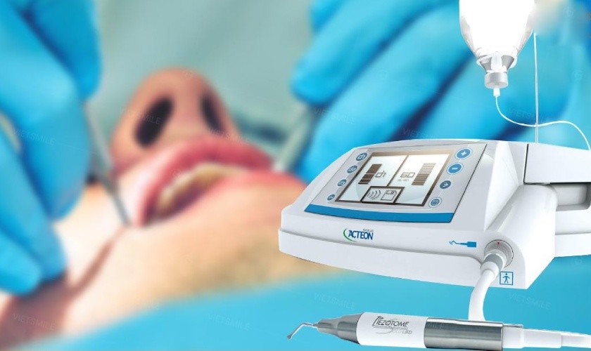 Máy siêu âm Piezotome giúp nhổ Tooth khôn Máy siêu âm Piezotome giúp nhổ Tooth khôn
