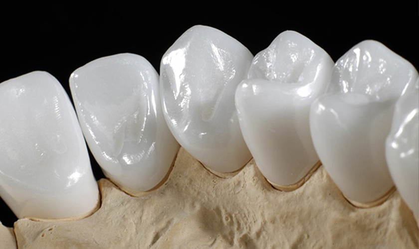 Cercon® Zirconia Systems