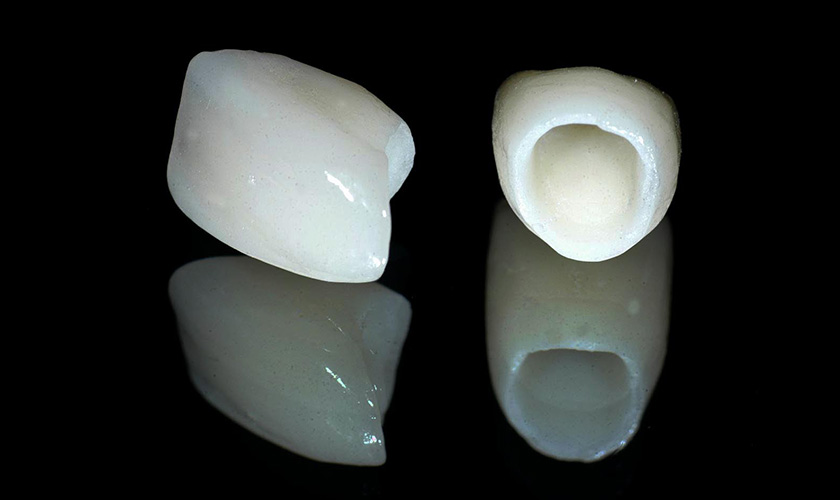 All-ceramic crowns