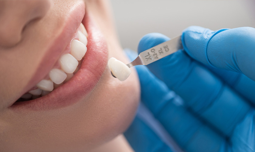Current price list of dental crowns at Nhan Tam Dental