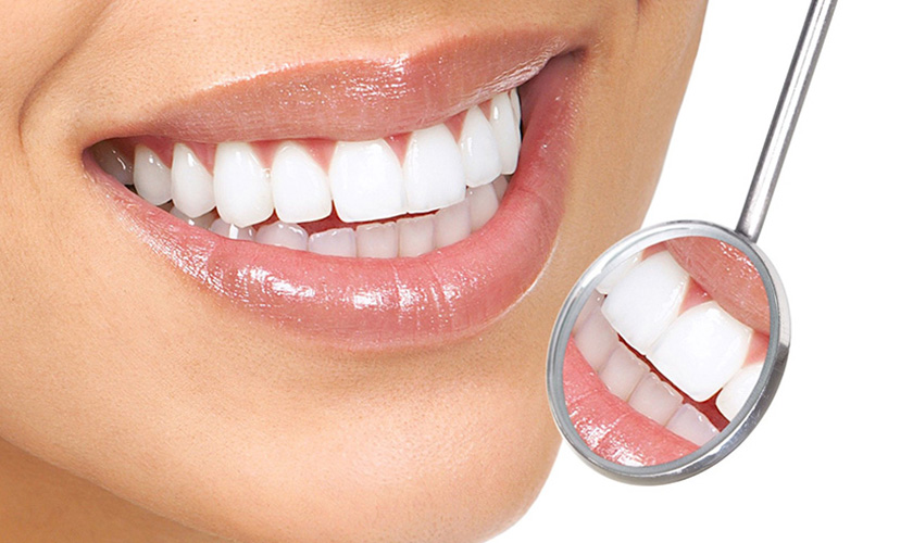 Dental crown consultant