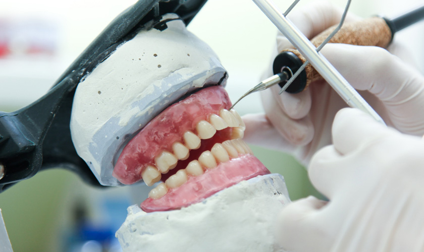 Crown fabrication procedure require absolute precision