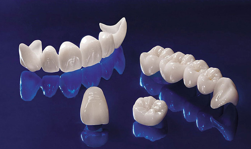 Cercon all porcelain teeth is a popular solution chosen by many customers