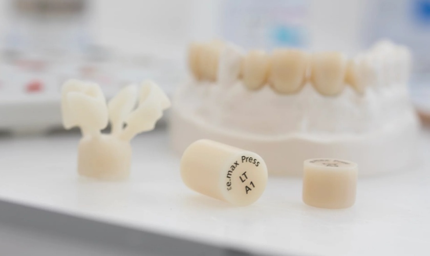 IPS EMAX Porcelain