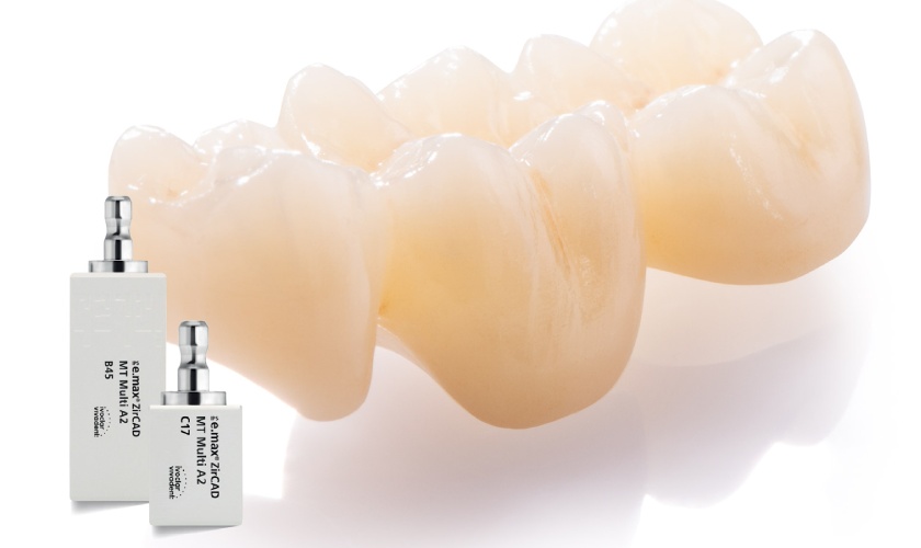IPS EMAX Porcelain