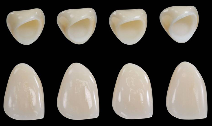 porcelain crowns
