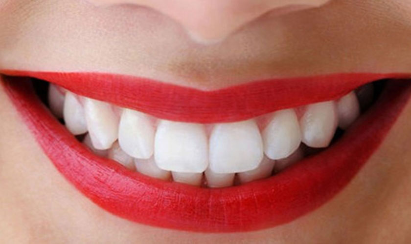 Dáng Tooth sứ tự nhiên