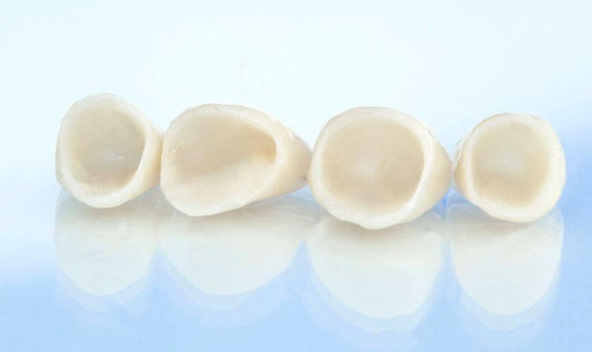 Tooth toàn sứ được chế tạo từ sứ nguyên chất