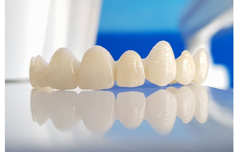 Giải mã bọc Tooth sứ giá rẻ