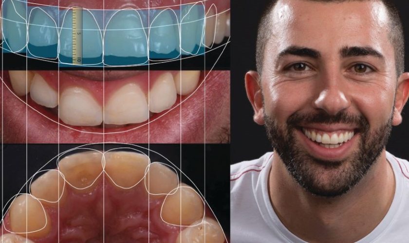 Smile design allows customers to preview treatment results