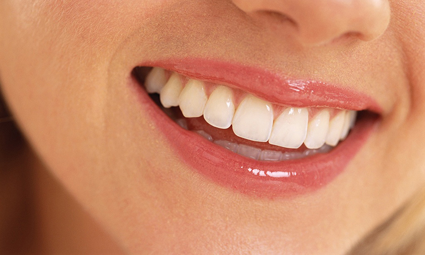 Reconstruction  of the gingival papilla in porcelain crowns restoration