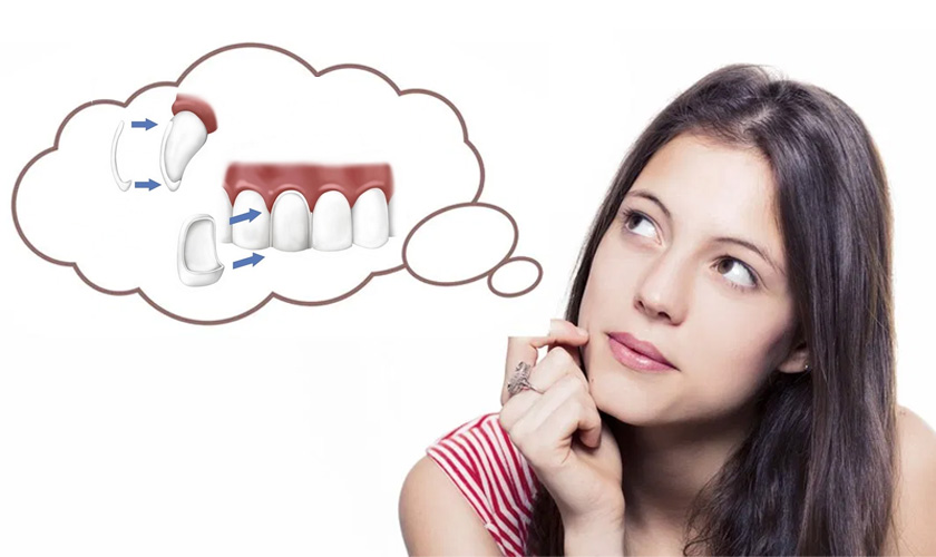Should be made porcelain veneers?