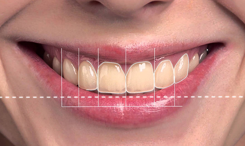 Defects in the smile