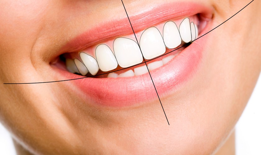 How much does it cost for smile design at Nhan Tam Dental?