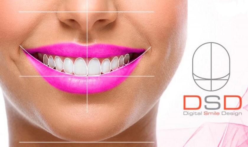 Smile Design - a technological advance of modern cosmetic dentistry