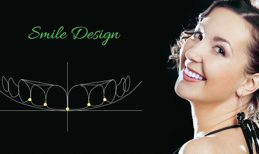 Beautiful smile - no longer a dream with smile design