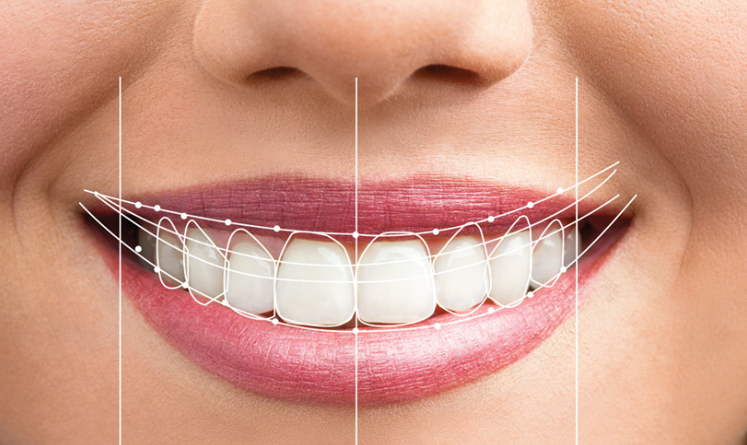 Smile design price list at Nhan Tam Dental