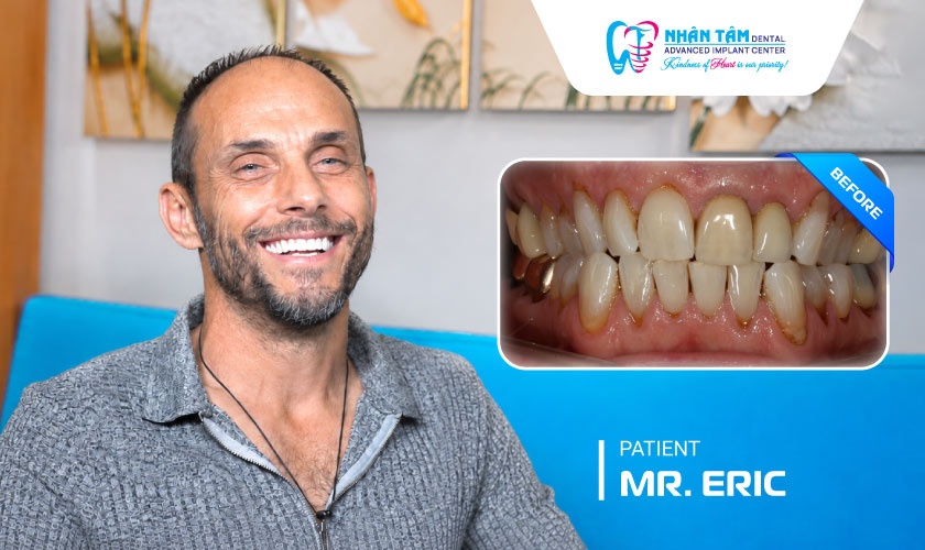Patient Mr. Eric