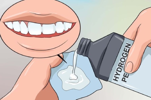 9 Natural Ways to Whiten Teeth at Home