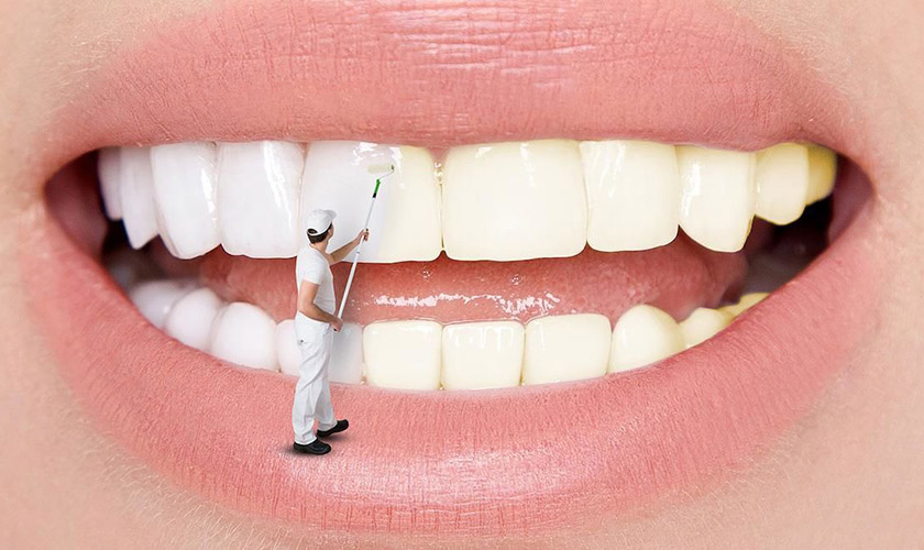 Is teeth whitening dangerous?