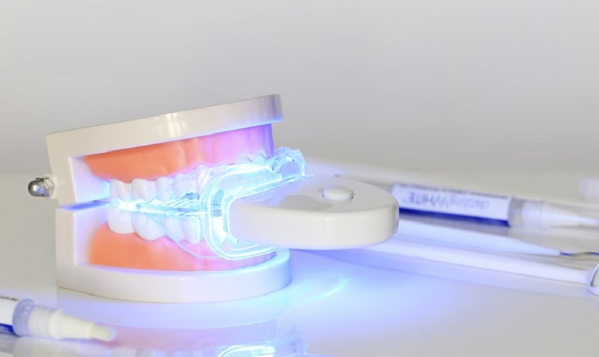 Laser Whitening – Safe, effective, long lasting