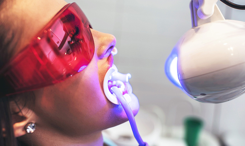 teeth whitening