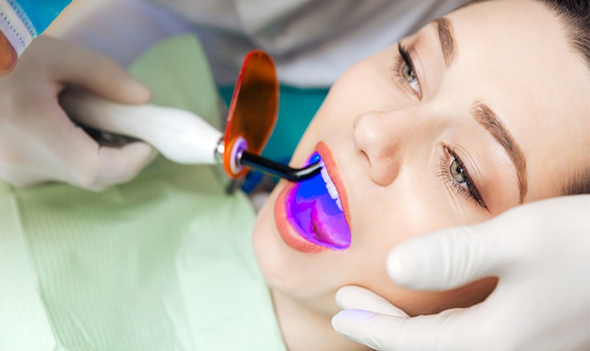 Teeth whitening