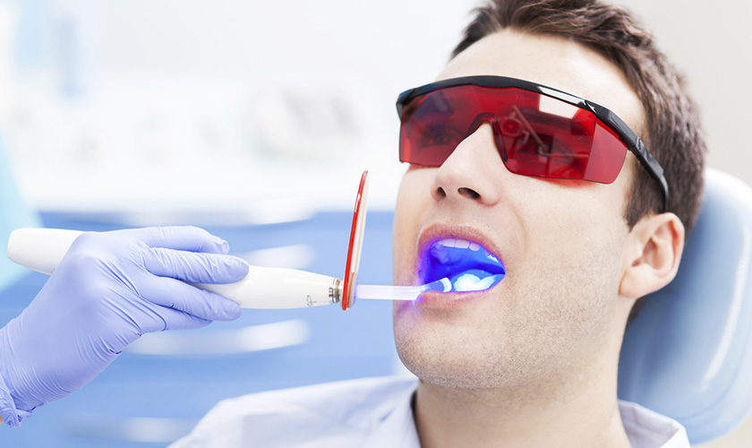 Which teeth whitening gel should be used?