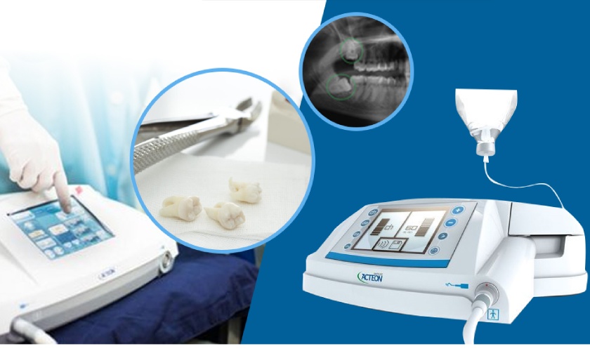 The ultrasonic tooth extraction device Piezotome