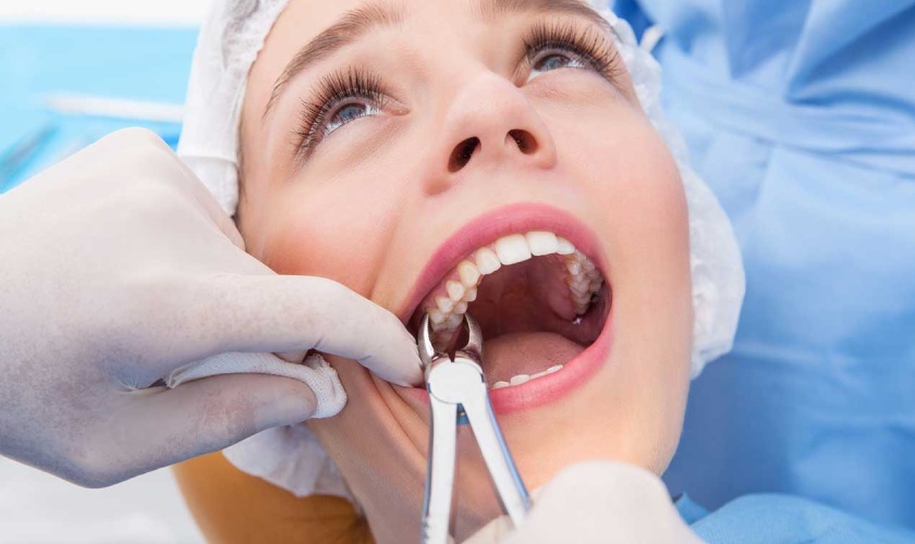 Advice after dental extraction