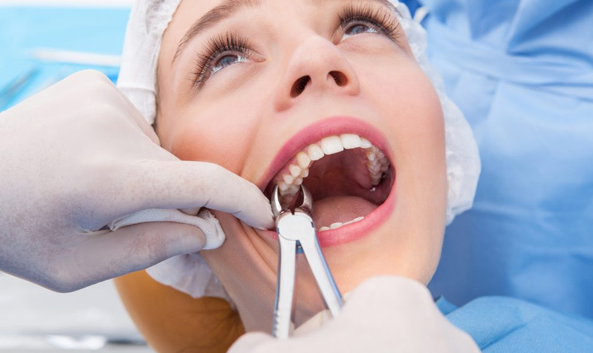 Incomplete extraction, in which a tooth root remains in the jaw